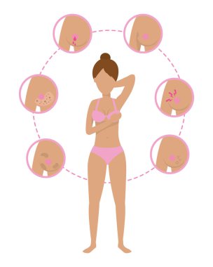 Kadınlar Meme kanseri