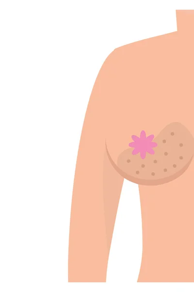 乳腺癌肿瘤标志 — 图库矢量图片