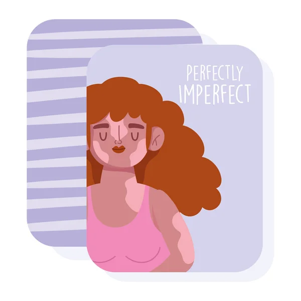 Perfectamente imperfecto, mujer de dibujos animados pelo rizado y enfermedad de vitiligo — Vector de stock