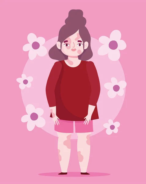 Perfect imperfect, cartoon mooie vrouw met probleem huid vitiligo, bloemen roze achtergrond — Stockvector