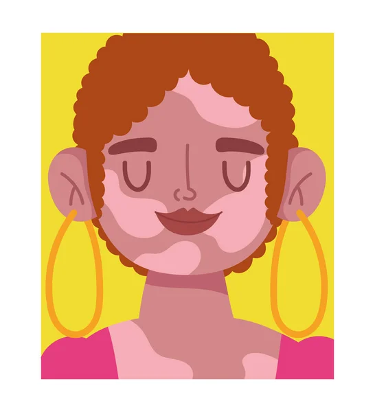 Vollkommen unvollkommen, Cartoon-Frau Gesicht mit Vitiligo-Krankheit — Stockvektor