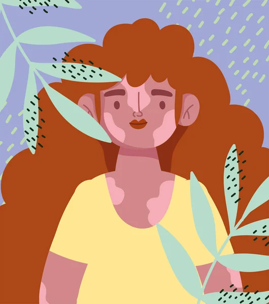 Perfekt unvollkommen, Zeichentrickmädchen lockiges Haar und Vitiligo, Blätter Dekorationskarte — Stockvektor