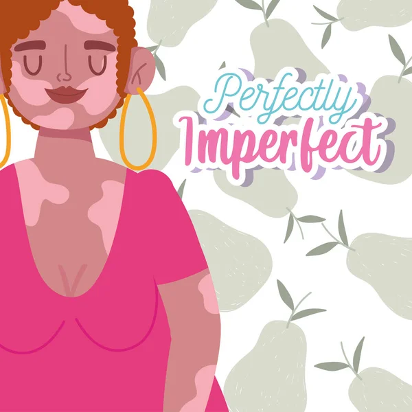 Perfekt unvollkommen, Cartoon Frau lockiges Haar und Vitiligo am Körper — Stockvektor