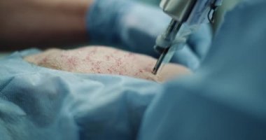 Cilt Bakımı vampirefacial veya prp için yeni bir buluş teknoloji ile çalışan portre doktor göstermek tüm süreç, mikro needling teknoloji