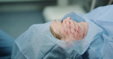 sandalyenin üstünde bırakmasını ve cilt bakımı için vampirefacial veya prp yordamı yordama devam edin Doktor bekliyor modern klinik hasta, Olgun kadın hasta yapmak Mezoterapi yüz için n