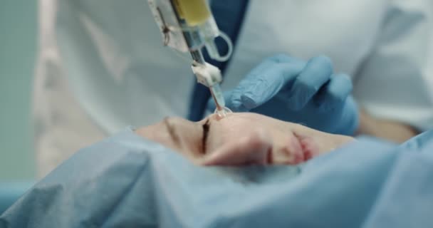 Portrét matur žena pacienta mají DZ nebo vampirefacial proceduru v moderní klinika využívající nový vynález pro péči o pleť. — Stock video