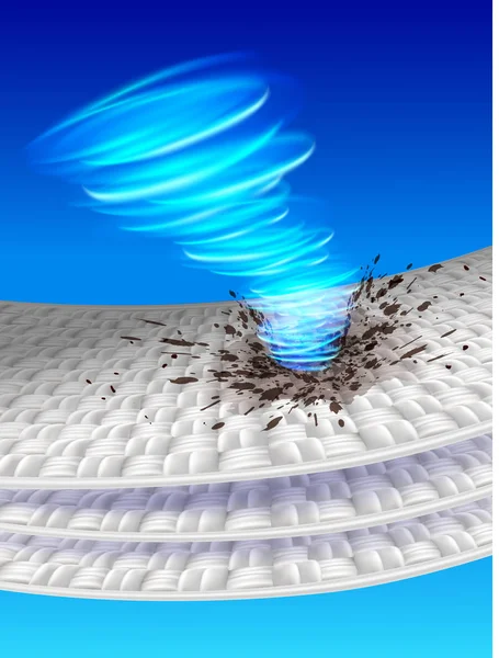 Görüntü Turbo Leke Kaldırma Gösterir Kir Iplik Kumaş Sıkışmış Deterjan — Stok Vektör