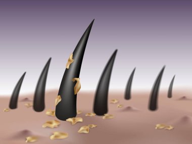 Saçında kepek, kafa derisinde mikrop, kabarcık ya da sivilce yapar..