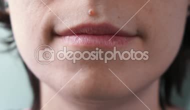 Smile Diş, 