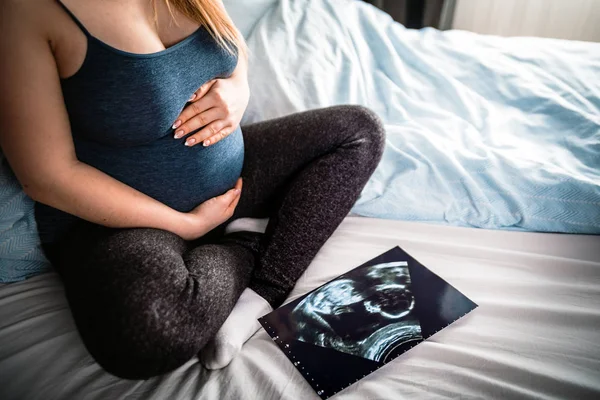 Беременная Женщина Сидит Кровати Смотрит Ультразвуковое Фото Своего Ребенка — стоковое фото