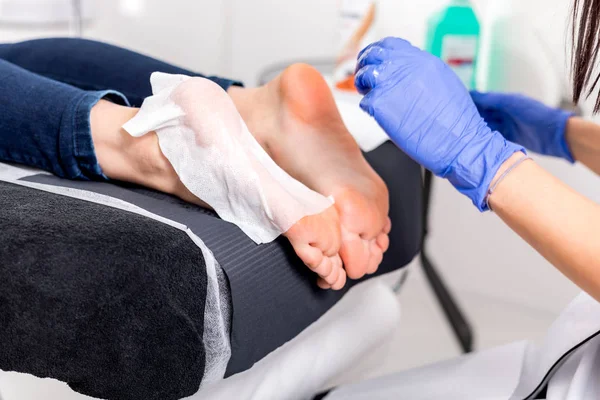 Kallus Peel Peeling Stóp Procedury Salonie Piękności — Zdjęcie stockowe