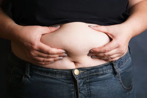 Overweight woman hands touching belly fat — Stock Photo, Image