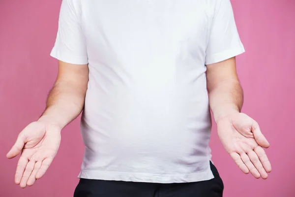 Matmissbruk Magen Fett Frossare Viktminskning Diet Skräpmat Fundersam Överviktig Man — Stockfoto