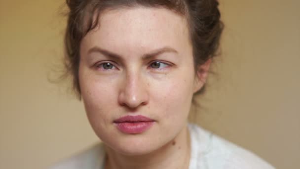 Portrét mladé ženy s lékařskou diagnózou šilhání. Koncept oftalmologie — Stock video