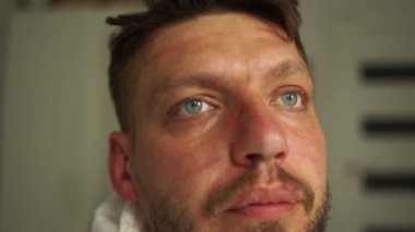 Yüzünde maske izleri olan yorgun bir doktorun yakın portresi. Bir adam maskesini çıkarır ve rahatça nefes alır. Doktorun Coronavirus covid-19 salgını sırasında yaptığı çalışma.