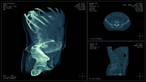 Body Scan Image Radiografisch Röntgenonderzoek Mri Tomografie Naadloos Lus Animatie — Stockvideo