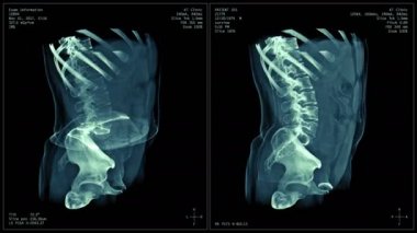 Vücut Ct tarama görüntüsü, radyografi x-Ray incelemesi, Mri tomografi sorunsuz döngülü animasyon, bilgi-grafik tarama ile gerçek vücut bilgisayarlı tomografi 3d görselleştirme.