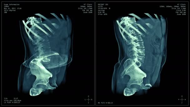 Body Kép Radiográfia Röntgen Vizsgálat Mri Tomográfia Zökkenőmentesen Végtelenített Animáció — Stock videók