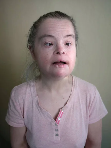 Söta Leende Downs Syndrom Kvinna — Stockfoto