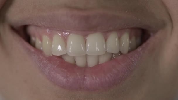 Close Up of African American Woman Teeth and Smiling — Stock Video