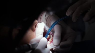 Diş hekimindeki genç bayan resepsiyon diş tellerinin değiştirilmesi jel cilalama