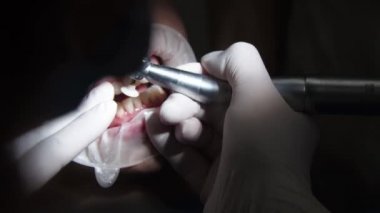 Diş hekimindeki genç bayan resepsiyon diş tellerinin değiştirilmesi jel cilalama