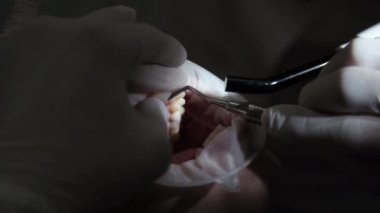 Diş hekimindeki genç bayan resepsiyon diş tellerinin değiştirilmesi jel cilalama