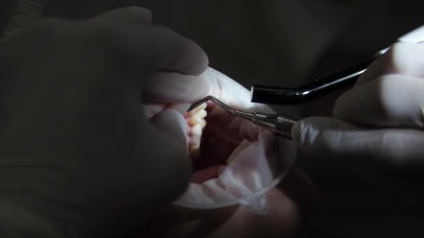 Jovem dentista Recepção no ortodontista Substituição de aparelho Polimento Gel ligação — Vídeo de Stock