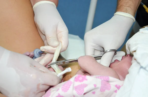 Cortar el cordón umbilical entre un bebé recién nacido y placenta. —  Fotos de Stock