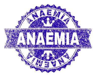 Dokulu anemi (kansızlık) damga mühür kurdele ile çizik