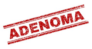 Dokulu Adenoma damga mühür çizik