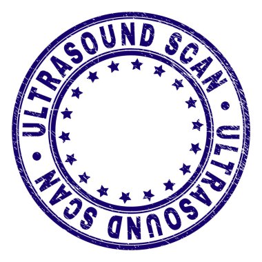 Çizik dokulu ultrason tarama yuvarlak damga mühür