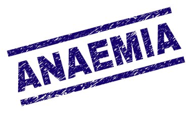 Dokulu anemi (kansızlık) damga mühür çizik