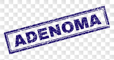 Çizik Adenoma dikdörtgen damgası