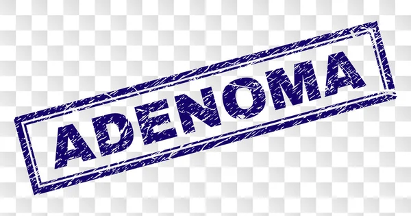 Çizik Adenoma dikdörtgen damgası