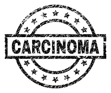 Dokulu Karsinomu damga mühür çizik