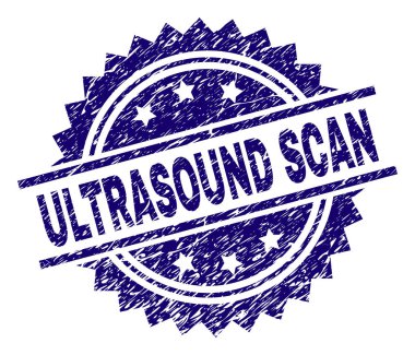 Dokulu ultrason tarama damga mühür çizik