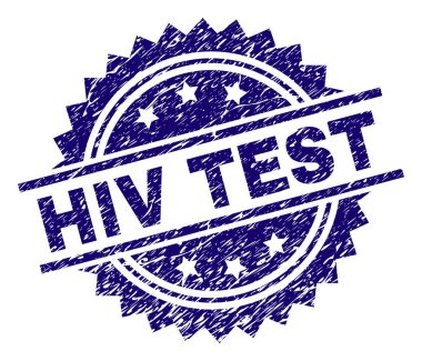 Dokulu HIV testi damga mühür çizik