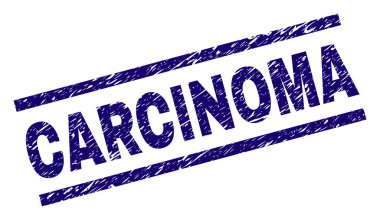 Grunge Karsinomu damga mühür dokulu