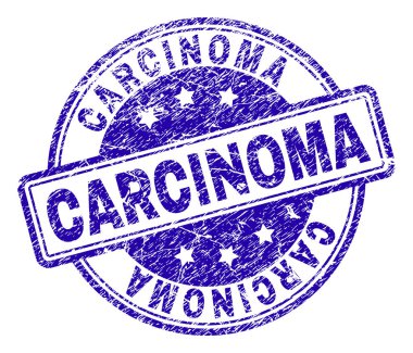 Grunge Karsinomu damga mühür dokulu