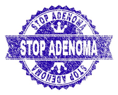 Adenoma rozet damga mühür yerleşimi grunge doku ile durdurmak. Yuvarlak rozet, şerit ve küçük kron ile tasarlanmıştır. Mavi vektör kauçuk filigran durdurmak Adenoma etiketinin doku ile.
