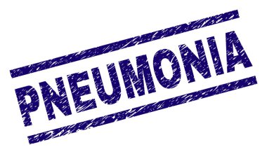 Dokulu pnömoni damga mühür çizik