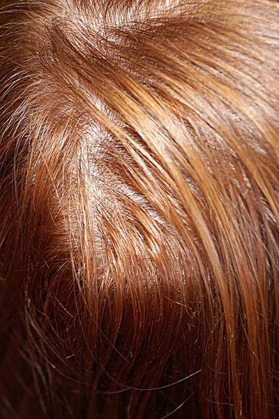 Γυναικείο Κεφάλι Κόκκινα Μαλλιά Κορυφαία Άποψη — Φωτογραφία Αρχείου