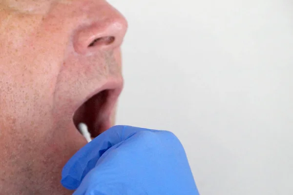 the doctor takes a test for coronavirus from the man\'s mouth.