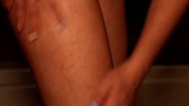 Γυναίκα Πασαλείβει Κρέμα Στα Πόδια Κυτταρίτιδα Και Κιρσούς — Αρχείο Βίντεο