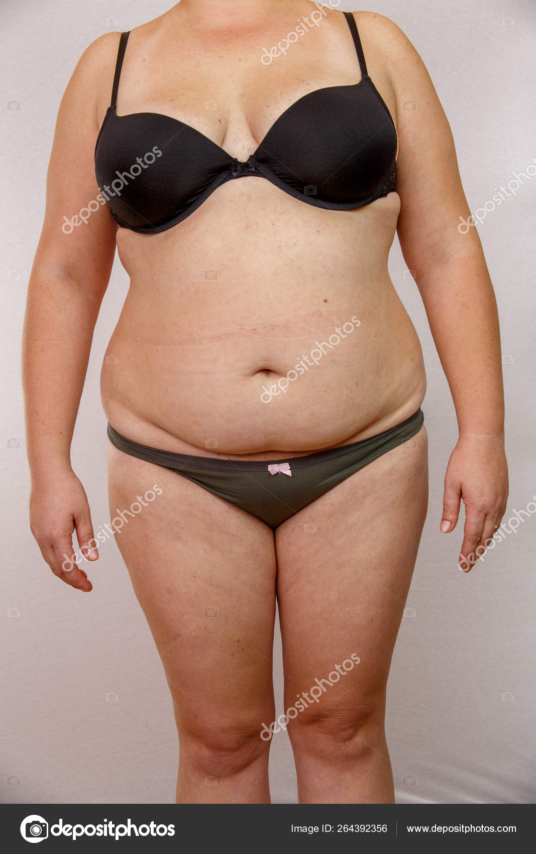 Obesity Woman Underwear Stock Photo by ©ajphotos 264392356