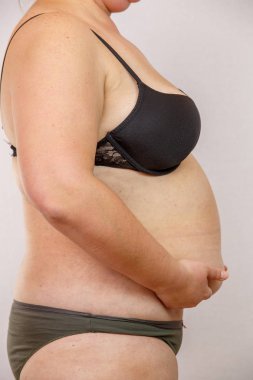 iç çamaşırı obezite kadın