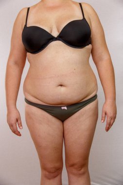 iç çamaşırı obezite kadın