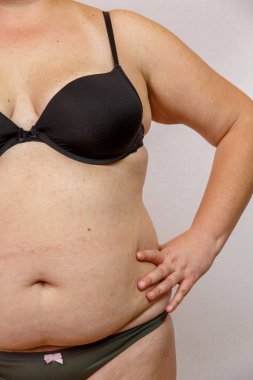 iç çamaşırı obezite kadın