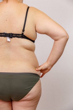 hormonal bozukluğu olan bir kadının portresi.geri